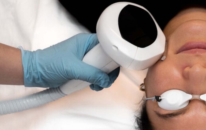 What Are the Benefits of Intense Pulsed Light Therapy